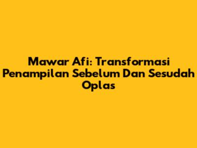 Mawar Afi: Transformasi Penampilan Sebelum Dan Sesudah Oplas