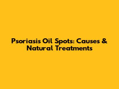 Psoriasis Oil Spots: Causes & Natural Treatments