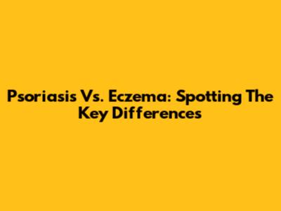Psoriasis Vs. Eczema: Spotting The Key Differences