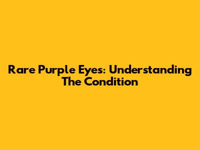 Rare Purple Eyes: Understanding The Condition